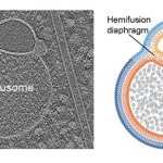 HEMIFUSOME