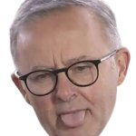 Anthony Albanese