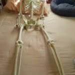 Skelly bed