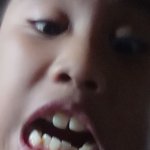Disgust ugly kid