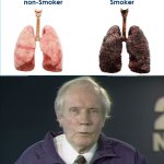 I'm sure you get it