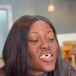 Gap teeth