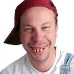 Dumb Guy With Bad Teeth