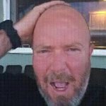 Bald man shocked 2 GIF Template