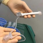 Trump's penis implant