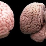 brain