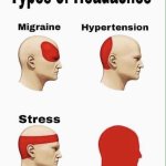 Headache