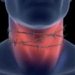Throat hurt