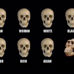 Comparison