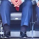Trump's Swollen Legs
