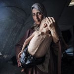 Starving Palestinian Child with mother