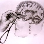 Time for a lobotomy