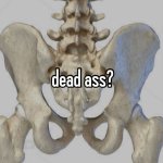 Dead ass?