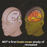 MIT brain scan