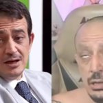 Before After