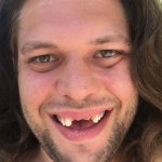 no teeth