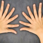 20 fingers meme