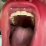 Guy screaming red