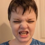 Stupid Face Syndrome