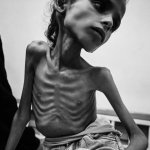 Famine in Gaza