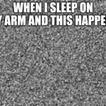 why | WHEN I SLEEP ON MY ARM AND THIS HAPPENS | image tagged in static,funny | made w/ Imgflip meme maker
