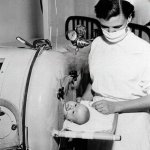 Baby in iron lung, pre-vaccine. Florida's finest.