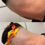 GROWING A NUTSACK BEFORE AND AFTER