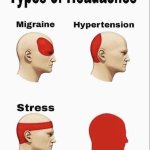 types of headaches
