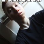 My blody nose | WHAT THE HEL OFF MY SCREEN RIGHT NOW | image tagged in my teplate | made w/ Imgflip meme maker