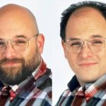 Bald or Balding meme