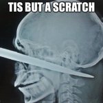 The X-Ray was fine, you can now go to the autopsy | TIS BUT A SCRATCH | image tagged in lobotomy,tis but a scratch | made w/ Imgflip meme maker