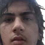 idnc about my face