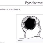 X Syndrome Instead of brain there X