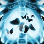 Butterflies in my tummy meme