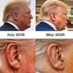 trump ear