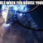 Shimo (GxK 2024) | SCHOOLS WHEN YOU BRUISE YOUR KNEE | image tagged in shimo gxk 2024 | made w/ Imgflip meme maker