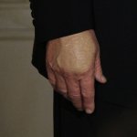 Trumps nasty hand