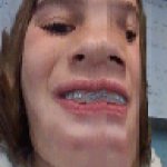 my head was flattened