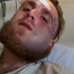 Jake Paul's broken jaw