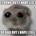 :( | YO GUYS I FOUND OUT I HAVE LEG CANCER :(; ITS NOT TOO BAD BUT I HOPE I FEEL BETTER :\ | image tagged in sad hamster,sas | made w/ Imgflip meme maker