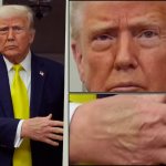 Skin of a killer fr Trump