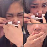 Nose piercing gone wrong