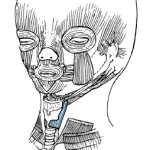 Horror Baby of Disdain