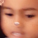 Zolaling facing other side