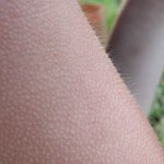 Goosebumps