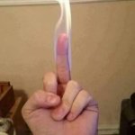 burning finger