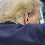 Donald Trump ear two weeks after being "shot"