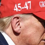 Donald Trump ear a year after it was "shot" off