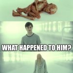 Dead Baby Voldemort / What Happened To Him | WHAT HAPPENED TO HIM? HE LEANED ON HIS CHIN ON THE BED FOR TOO LONG | image tagged in dead baby voldemort / what happened to him | made w/ Imgflip meme maker