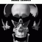 skull issues